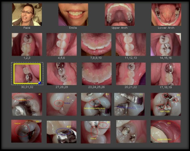 Dental TI’s complete intraoral camera exam.