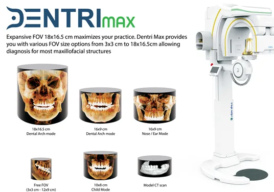 HDXWill DentriMax CBCT and FOVs 