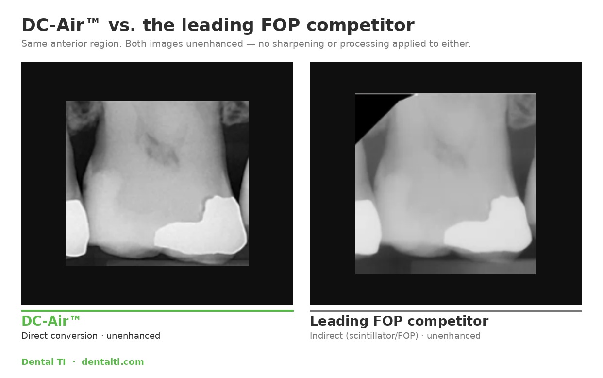 Comparison of dental X-ray images: DC-Air™ direct conversion technology on the left shows a sharper image compared to the leading FOP competitor’s indirect scintillator on the right. Both images unenhanced.