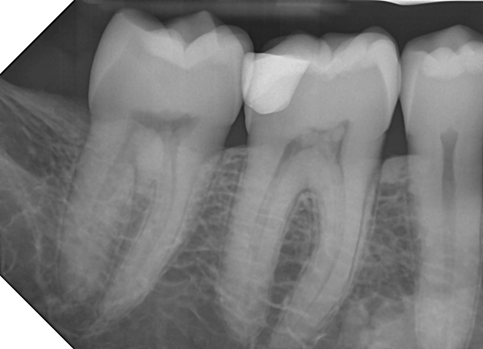 Prime View Ultra - Low Dose and Exceptional Image Quality