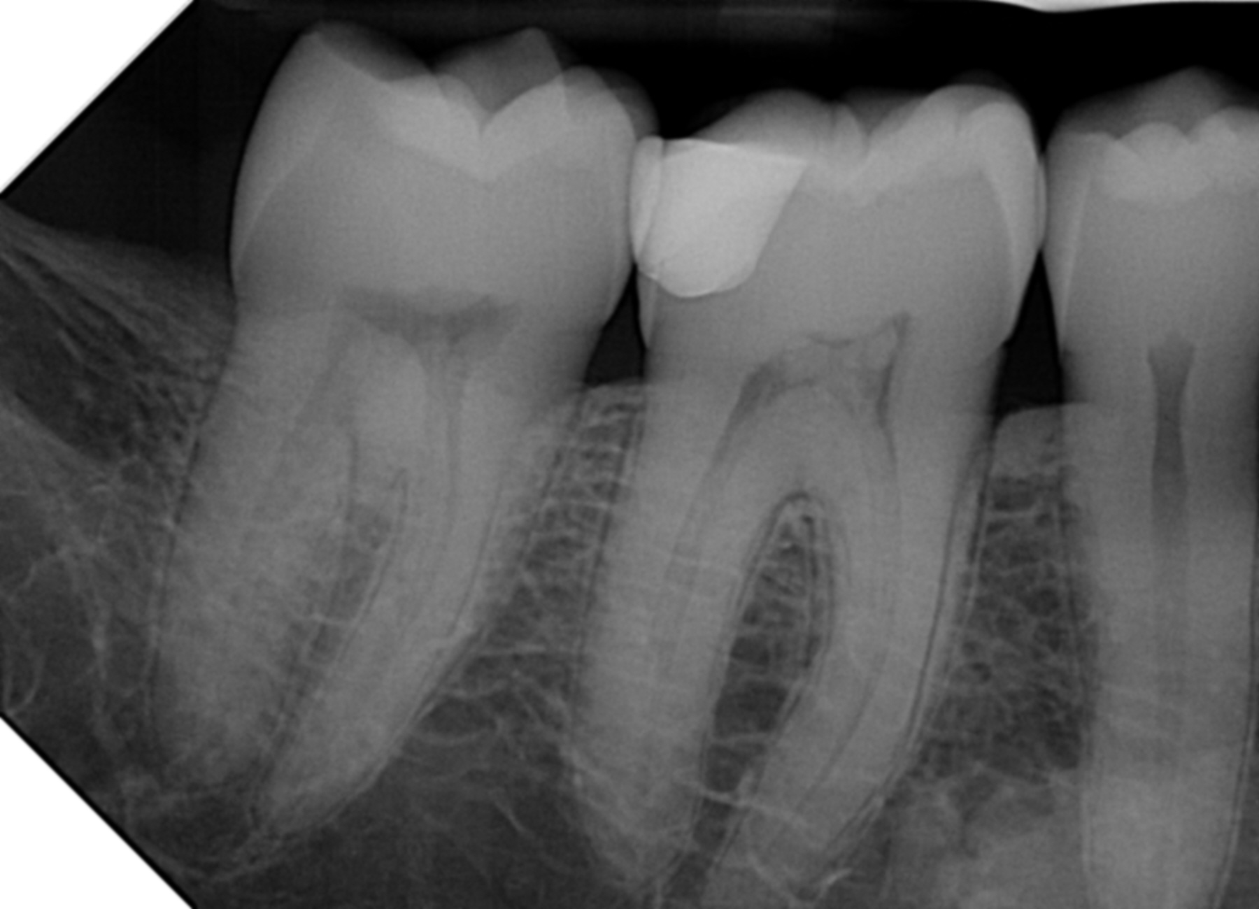 Same PrimeView Ultra image with post processing sharpening and contrast adjustments applied. 