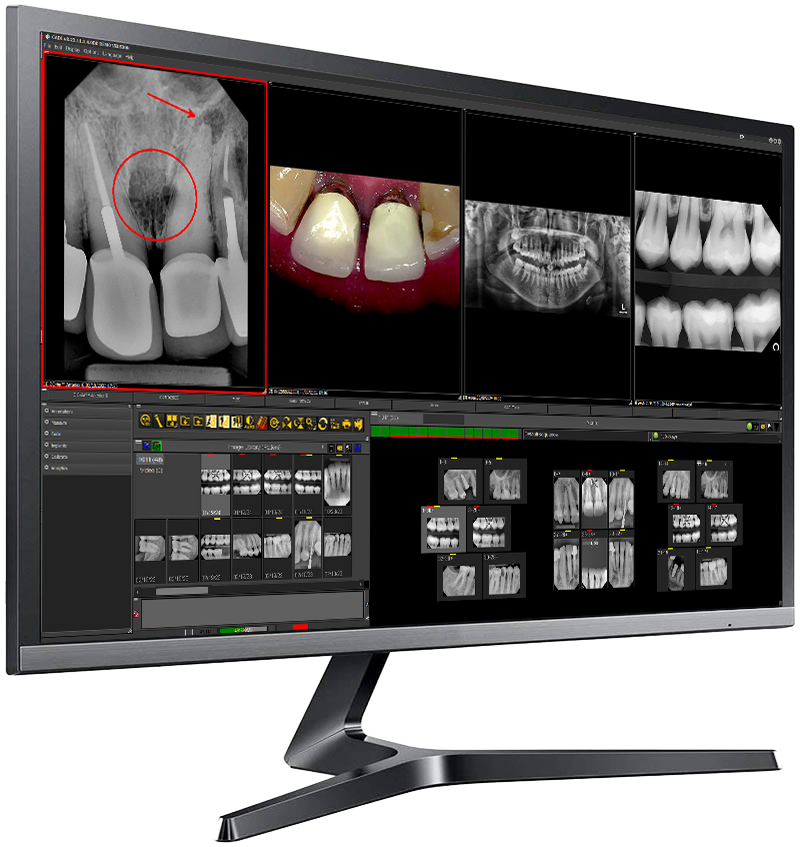 CADI Advanced Imaging software